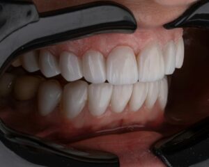 la bouche d'une personne avec des dents